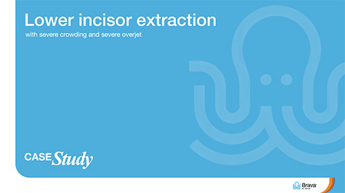 case-lower-incisor-extraciton