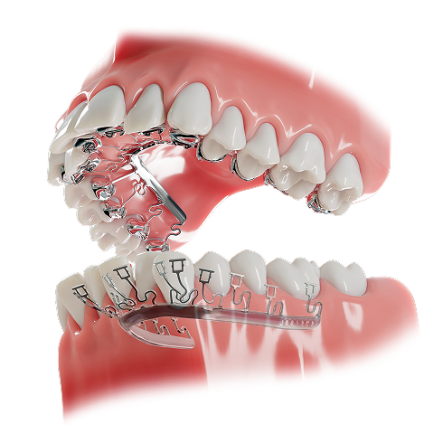 Class-I-Perspective-001-6in 1