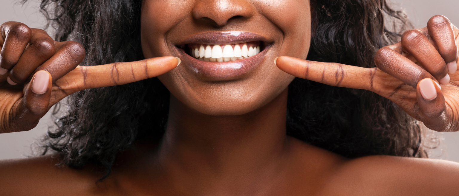 Invisible braces before and after